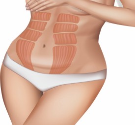 Whattoexpectduringabdominoplastytummytuckrecovery