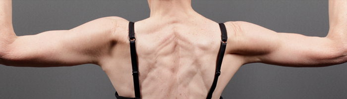 After Procedure